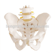 Modelo de pelvis humano com modelo de vértebra lombar 2pcs, modelo de piso pélvico